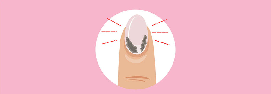 Hur uppstår allergier av nagelprodukter?